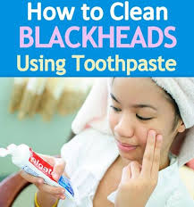 Annie Collazo (redlips00)