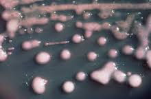 Bakteria ta u nosicieli prowadzi do zagrożenia życia. New Delhi Metallo Beta Lactamase 1 Wikipedia