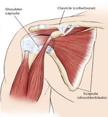 Image result for Frozen Shoulder
