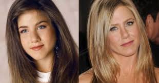 After Jennifer Aniston Had A Nose Job I Had A Deviated Septum Fixed Best Thing I Ever Did I Slep Jennifer Aniston Nose Jennifer Aniston Nose Job Nose Job