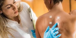 Image result for Allergy Screening