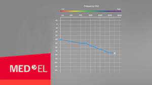 If a youtube export is selected in the section external services, the. Audiograms Explained Med El Youtube