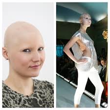 Anna Reeve, NZ Alopecia respond to Chris Rock's cruel Oscars joke