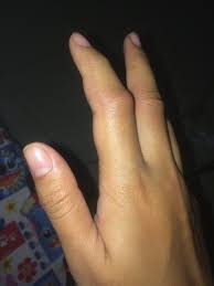 Terletak antara ibu jari (jari pertama) dan jari tengah (jari ketiga). Tire On Twitter Perbandingan Ibu Jari Dan Bapak Jari Telunjuk