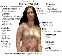 Other symptoms include tiredness to a degree that normal activities are. Fibromyalgia Wikipedia