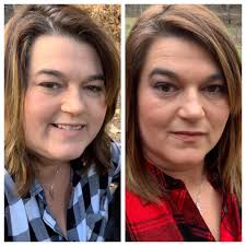 Is there a difference in your face since losing weight?