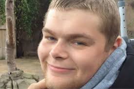 What your dermatologist removes will be looked at under a microscope. Teenager With Bone Cancer Didn T Tell Closest Friends He Had Days Left To Live So They Didn T Worry Mirror Online