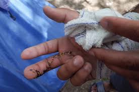 Savesave prendre soin de son ame for later. Le Cout De L Aide Medicale D Etat Ame Passera La Barre Du Milliard D Euros En 2021 Infomigrants