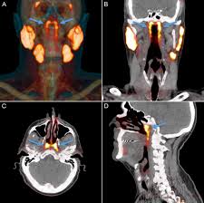 Pin Em Anatomia