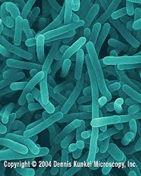 When it contaminates food, you can't see, smell. Listeria Microbewiki