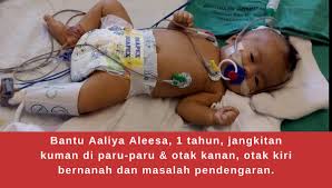 Walau bagaimanapun, beberapa penyelidik perubatan dan ahli kesihatan mengesyaki bahawa kuman yang hidup di dalam otak mungkin menjadi punca alzheimer. Kitafund Bantu Baby Aaliya Aleesa 1 Tahun Jangkitan Facebook