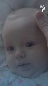 🧠 A craniossinostose é uma condição que pode passar despercebida nos  primeiros meses de vida, mas pode impactar o crescimento e o  desenvolvimento cerebral do bebê., Mesmo sem sintomas aparentes, a ...