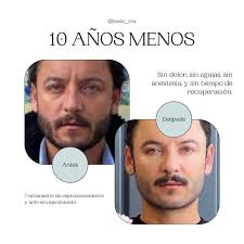 Si estás por comenzar tu tratamiento de depilación definitiva, debes  asegurarte que el centro utilice aparatología médica, somos los únicos a  nivel estatal que tiene este tipo de tecnología!! En BEAU te