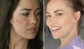 Jun 26, 2021 · bir kadının en güzel hali, doğal halidir. Fahriye Evcen Estetik Mi Yaptirdi