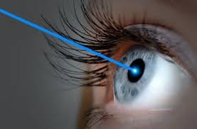 Steven trokel and his colleges performed the. The Lasik Procedure How Lasik Eye Surgery Works