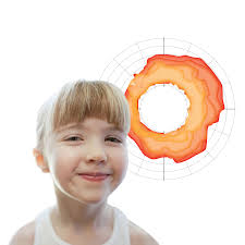 Interview: An epidemiologist powers Trayt's patient and population health  data for Access Programs