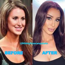 90 day fiance star post-surgery transformation