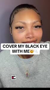 How to cover a black eye if your ever in need 😂 I think ms @Rare Beauty &  ms @Huda Beauty did the trick! What should I try next? #sephora #rarebeauty  #hudabeauty #blackeye #coverup #surgerytiktok