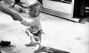 Image result for Thalidomide