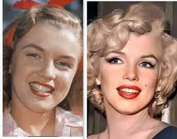 90 Day Fiance star's nose job improvement