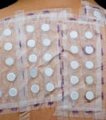 Image result for Patch Testing