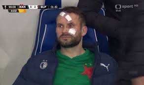 Ten přitom v odvetě v glasgow (hráno 18. Rangers Slavia Ondrej Kolar V Krvi Brutalni Kopacka Do Obliceje Isport Cz