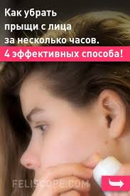 карта прыщиков на лице и как с ними бороться Kak Ubrat Pryshi S Lica Za Neskolko Chasov 4 Effektivnyh Sposoba Lico Lechenie Pryshej Chistoe Lico