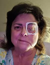 My name is Magdelina Biswas Please Pray For Me I have a pain in my left  side of my tongue, cheek ... I had done my biopsy but they didn't get any