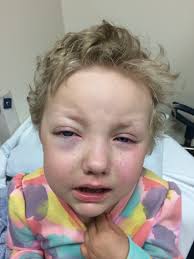 Dr. Soheil Meshinchi