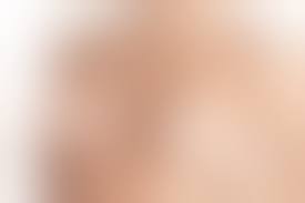 Процесс восстановления после коррекции груди