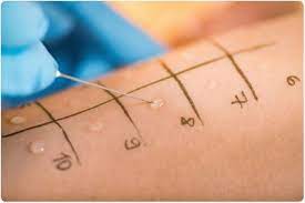 To diagnose a food allergy for certain, an allergist might do a blood test in addition to skin testing. Can Food Allergies Ever Be Psychological