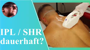 Deswegen haben wir für dich verschiedene geräte im ipl haarentfernung test geprüft. Manner Rucken Ipl Shr Dauerhafte Haarentfernung Youtube