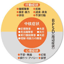 アルツハイマー型認知症は、 「認知症と言えばアルツハイマー」 と連想されるほど代表的な認知症と言えるでしょう。 アルツハイマー型認知症の症状には、さまざまな特徴があります。 初期症状に起きる軽い物忘れや人格の変化、短期記憶の低下などは、よく見ていないと見過ごしてしまう. èªçŸ¥ç—‡ã®ç—‡çŠ¶ ä¸­æ ¸ç—‡çŠ¶ã¨å'¨è¾ºç—‡çŠ¶ Bpsd ã¨ã¯ ãªã‹ã¾ãã‚‹