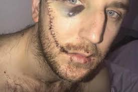 Apprentice star Totton faces backlash over offers to help knife attack  Everton fan