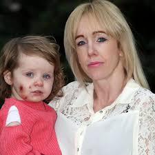Toddler scarred for life after being bitten 15 TIMES at soft play centre