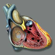 Image result for Ventricular Septal Defect