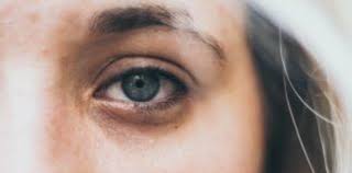 What happens if you sleep with contacts on. What Happens When You Sleep With Contacts Archives Medical News Bulletin