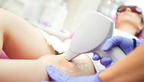 Dragon tattoos and applications for women. Lazer Epilasyon Her Bolgeye Uygulanir Mi