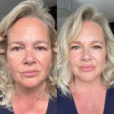 Attention, busy beauties! Feeling stressed and no time for makeup? Try our  BB Glow treatment! It gives you a radiant, flawless look without the need  for foundation—perfect for anyone