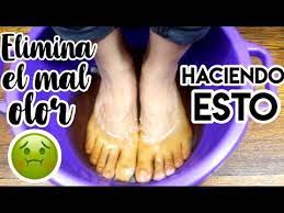 Elimina El Hongo El Mal Olor En Los Pies Si Funciona Youtube