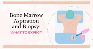 Image result for Bone Marrow Exam
