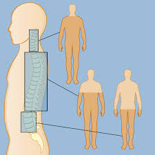 Image result for Spinal Trauma