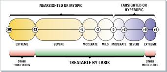 rajkot lasik surgery rajkot wavefront lasik rajkot laser