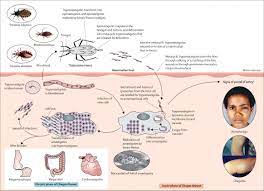 Chagas Disease The Lancet