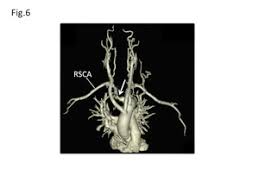Presentation refers to the part of the fetus's body that leads the way out through the birth canal. Epos