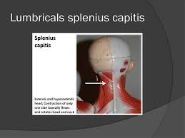 A dorsal raphe and a midline fascial septum. Origin 1 Lower Portion Of Ligamentum Nuchae 2 Spinous Processes Of C3 T3 4 Insertion 1 Superior Nuchal Line 2 Mastoid Process Of Temporal Bone Action Ppt Download