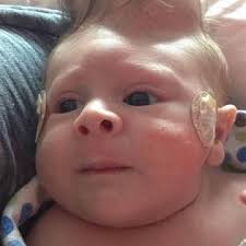 Baby Bentley overleeft met brein buiten zijn schedel