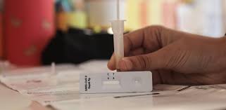 Το μοριακό τεστ αποτελεί προς το παρόν την πιο έγκυρη μέθοδο για τη διάγνωση του ιού. Korwnoios Ypoxrewtiko Self Test Sto Dhmosio Apo Th Megalh Deytera E Thessalia Gr
