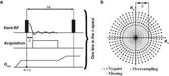 Soft tissue injuries are difficult to shoulder injuries should focus on the stabilization of the opposing area as well. Magnetic Resonance Imaging Of Hard Tissues And Hard Tissue Engineered Bio Substitutes Springerlink