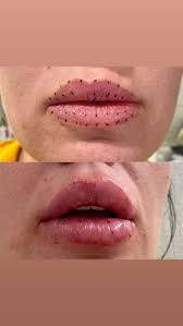 Pin On Halo Haus Of Beauty Intentional Skin Care Aesthetics